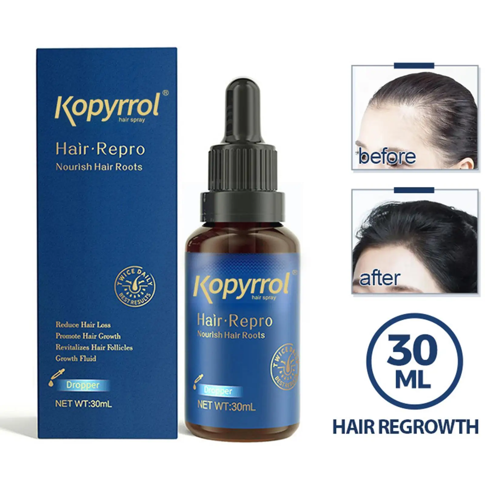 

30ml Anti-Hair Loss Treatment Essence Men Women Prevent Hair Scalp Hair Repair Root Loss Hair Serum Damaged Care Products G E9C1