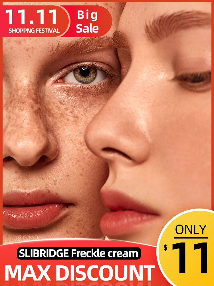 

freckles removal cream Remove spot for face removing dark brown black age pigment spots melasma freckle remover