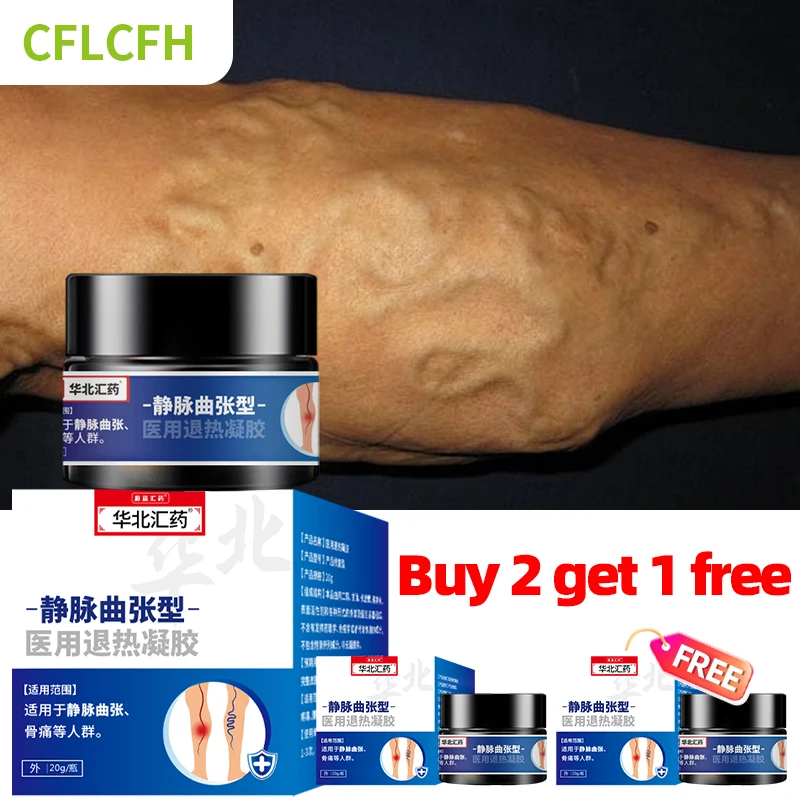 3 коробки крем для удаления варикозного расширения вен китайский медицинский