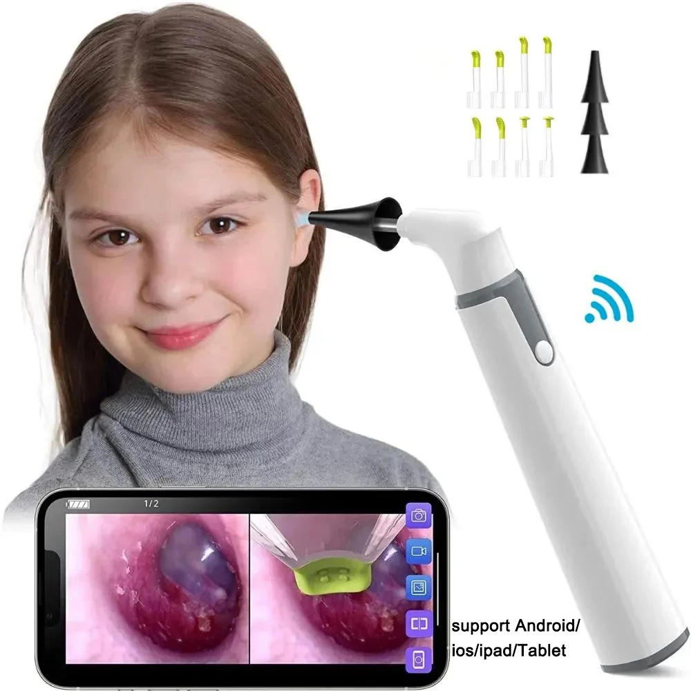 Фото Беспроводная камера для отоскопа 3,9 мм 1080P HD WiFi ушной прибор с 6 светодиодными лампами для детей и взрослых Поддержка Android и iPhone №1