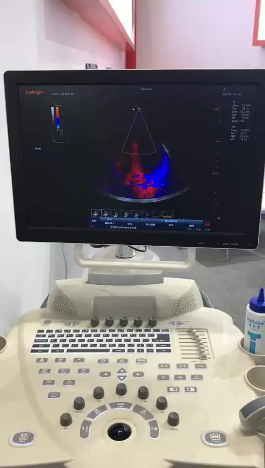 High end image quality the best professional OB GYN ultrasound  color doppler 3D ultrasound machine price