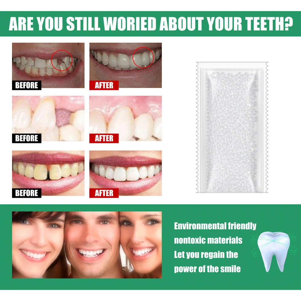 

100/50g Temporary Tooth Repair Kit Teeth And Gaps Falseteeth Solid Glue Denture Adhesive For Denture Repair Teeth Orthodontics