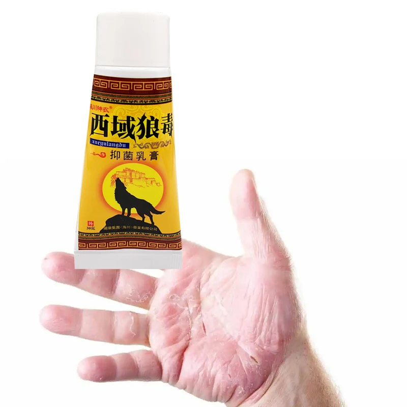 

30gG Wolf Poison Cream Anti-bacterial Ointment Rotten Feet Itchy Skin Dermatitis Eczema Plaster Foot Care Herbal Essence