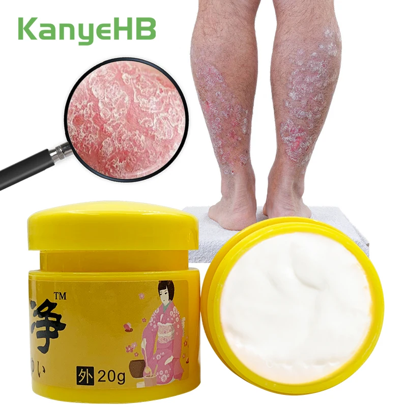

2Pcs Eczema Treatment Ointment Antibacterial Skin Psoriasis Cream Treat Dermatitis Skin Rash Urticaria Desquamation Cream A1072