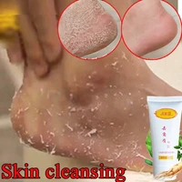 1pc 30g peeling gel facial exfoliating peeling lotion scrub deep clean acne blackhead remove face cleanser whitening oil control
