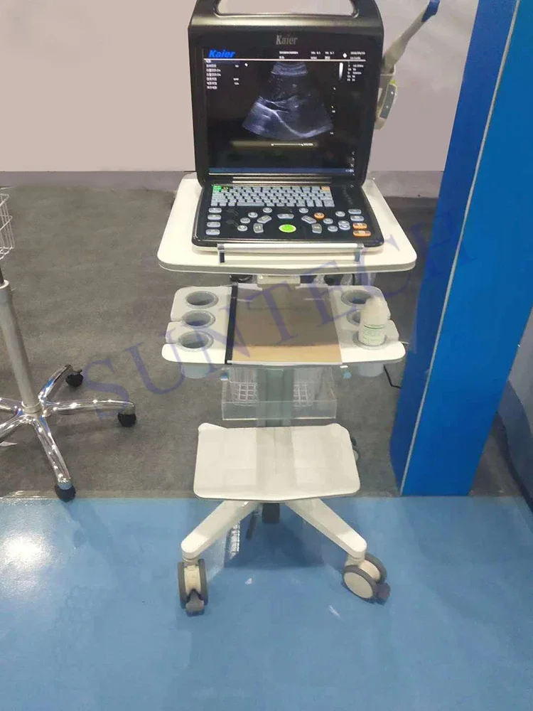 На заказ ультразвуковая тележка для сканирования sonix с дополнительной батареей