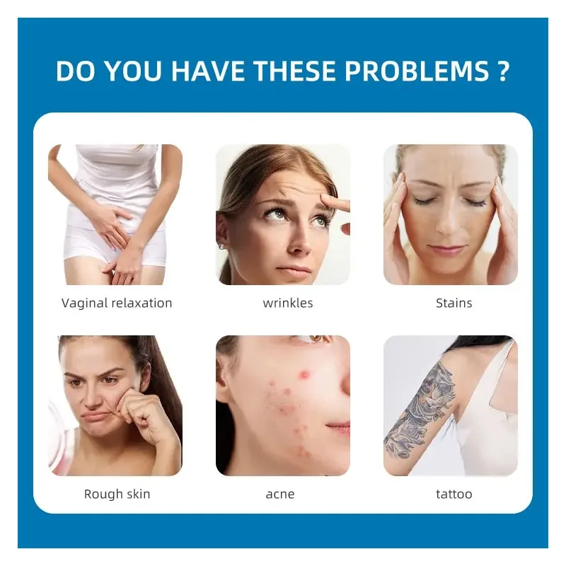 Портативная профессиональная Fotona Co2 фракционное омоложение кожи резервная