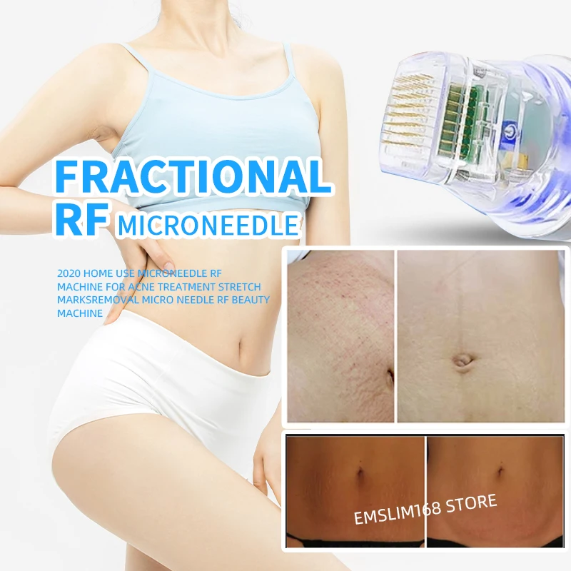 Новинка 2022 фракционная микроигла радиочастотная косметическая