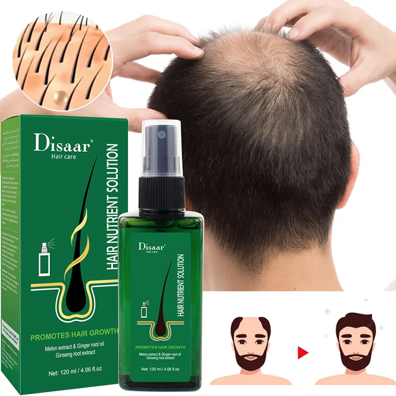 

Ginger Essential Oil Hair Serum Neo Lotion Para El Pelo For Growth Cheveux Homme Queda De Cabelo Tratamento Proteses Mulheres