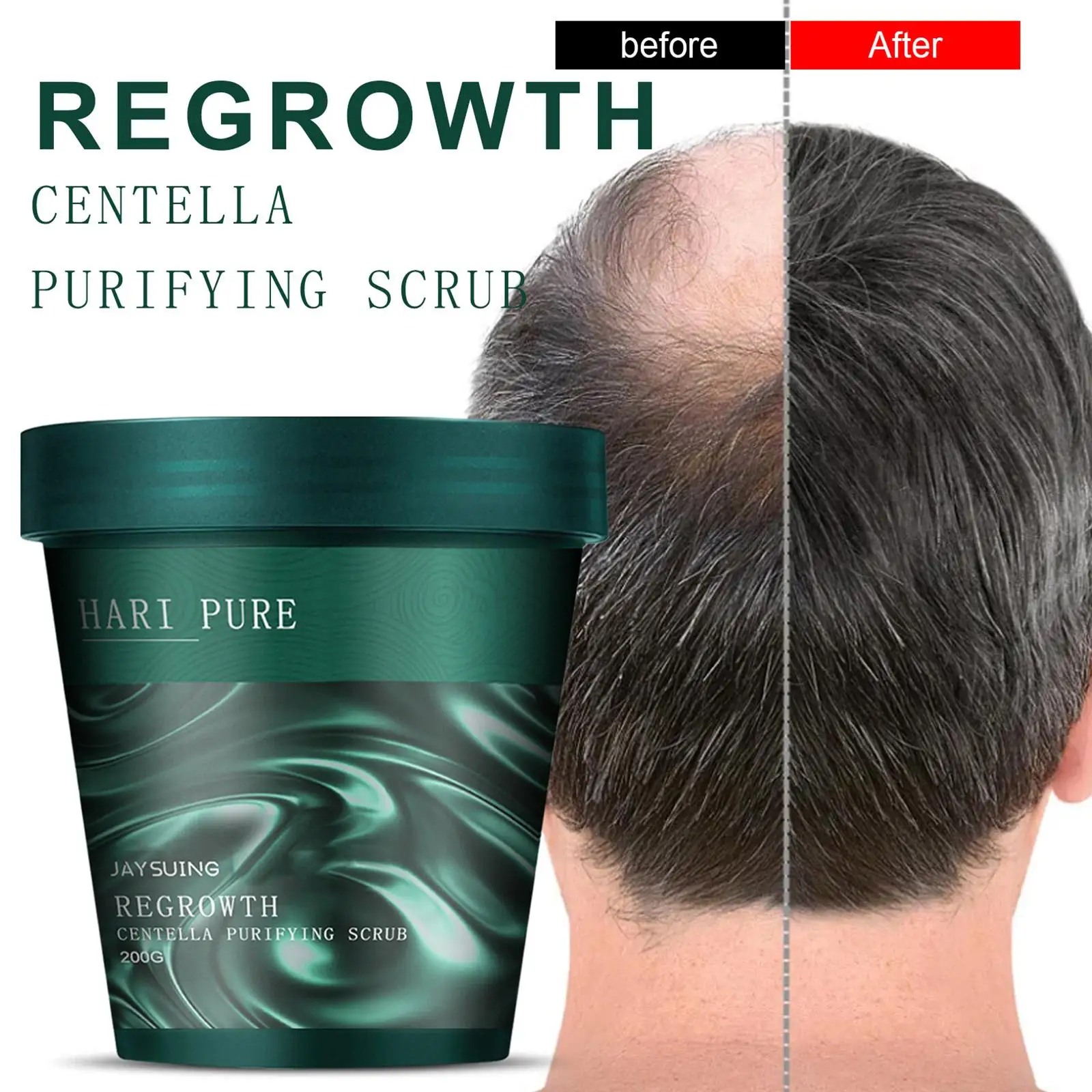 

2022 New Centella Purifying Scrub Hair Cleansing Anti-dandruff Anti-itching Care Scalp Anti-Growing Scrub 200g