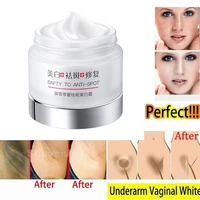 herbal whitening face cream removal pigmentation melasma pigment melanin dark spots sunburn kojic acid brightening face cream