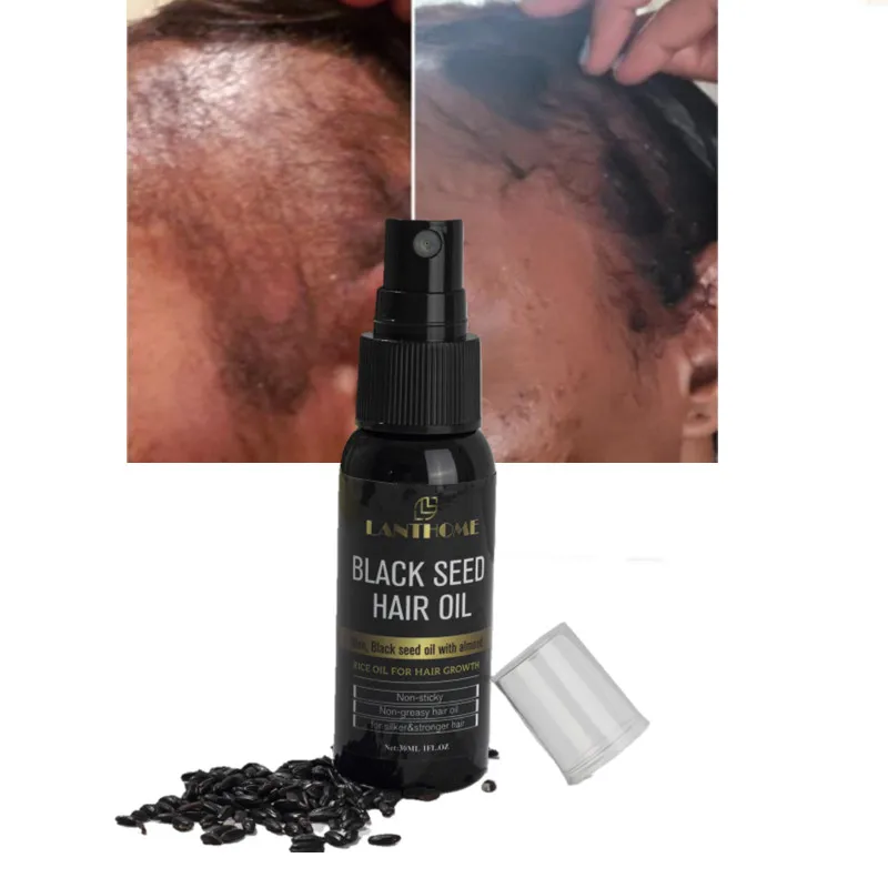

Эссенция для роста волос Black Rice, сыворотка для прорастания волос, натуральное масло для выпадения волос, лечение кожи головы для мужчин и жен...