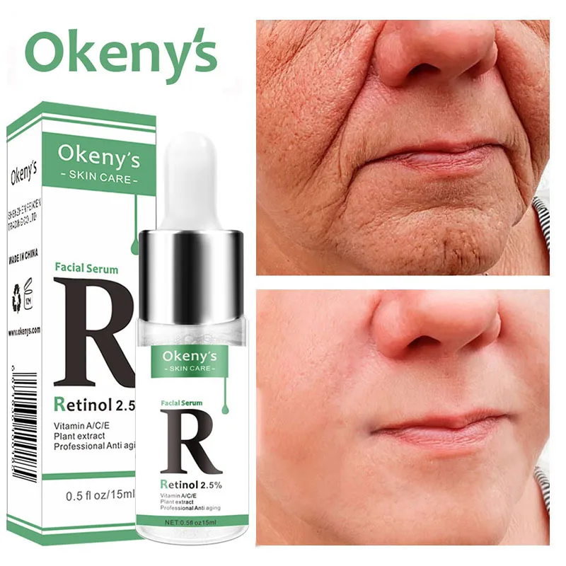 

Retinol Removal Wrinkle Serum Lifting Firming Anti-Aging Face Essence Vitamin C Fade Dark Spots Whiten Brighten Beauty Skin Care