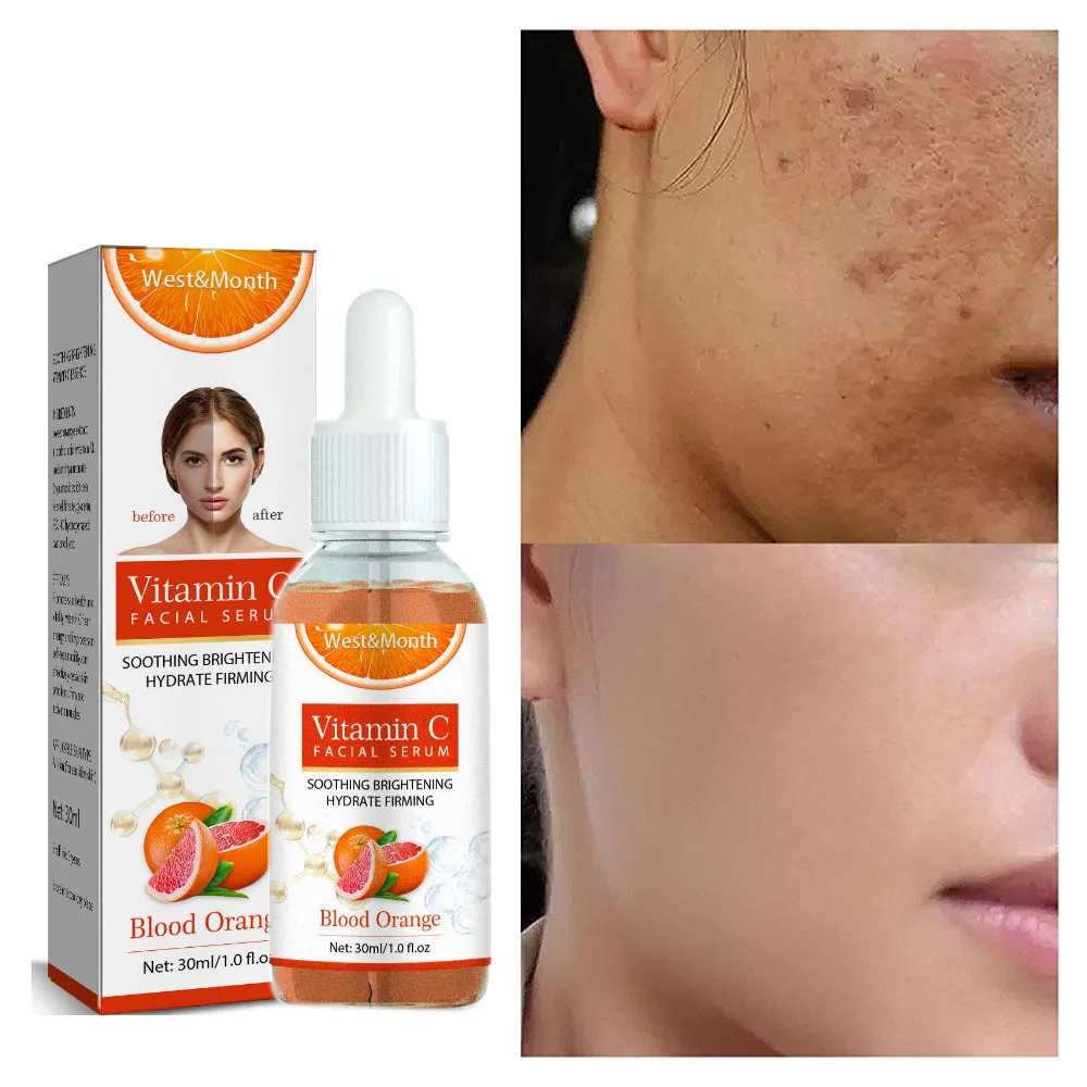 

Vitamin C Whitening Serum Fade Dark Spots Improve Dull Face Brighten Skin Care Products Hyaluronic Acid Moisturising Cosmetics