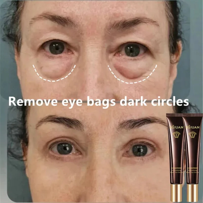 

Оригинальный крем для кожи вокруг глаз от Тёмных кругов и мешков