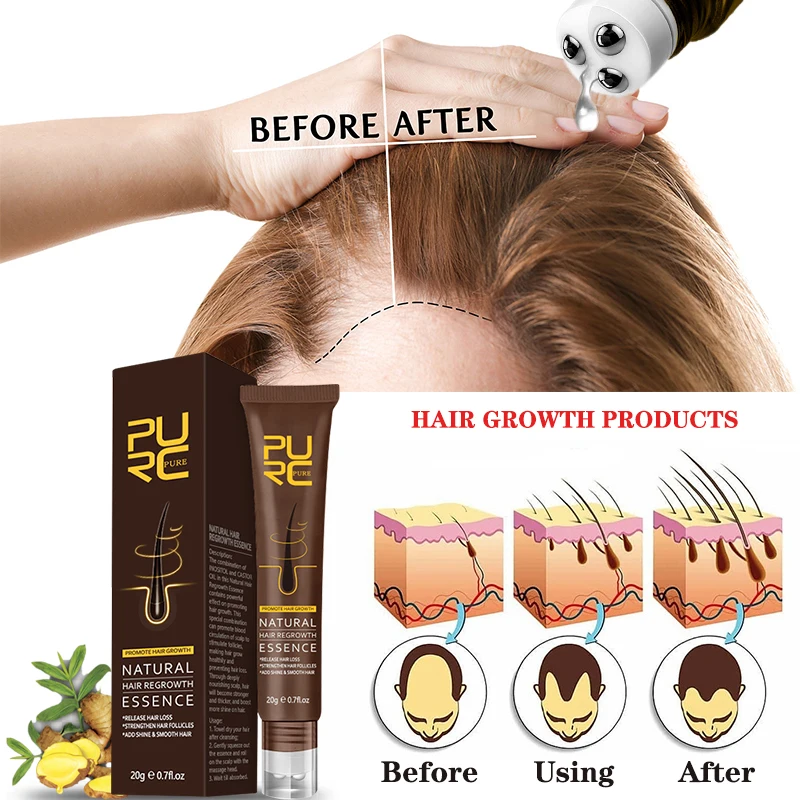 

PURC Fast Hair Growth Essence Oil Ginger Prevent Hair Loss Scalp Treatment Serum Regrowth Thickening Hair Care Women Men Beauty