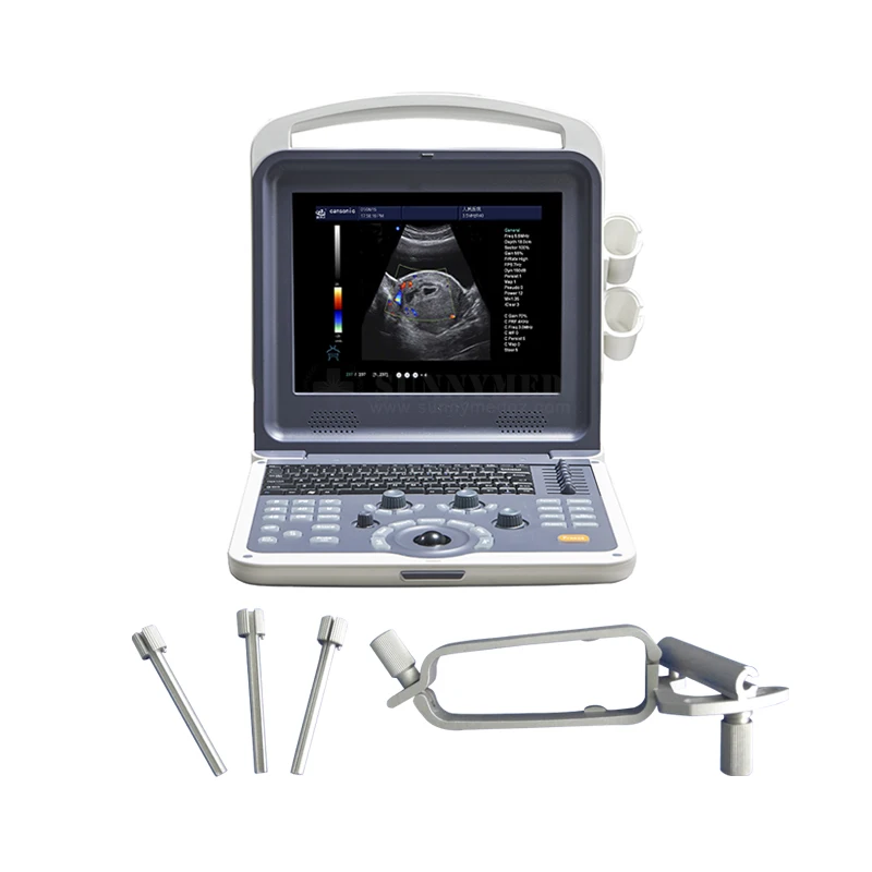 

SY-A042N Portable obstetrics and gynecology ultrasound machine 4D