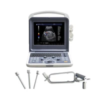 sy a042n portable obstetrics and gynecology ultrasound machine 4d