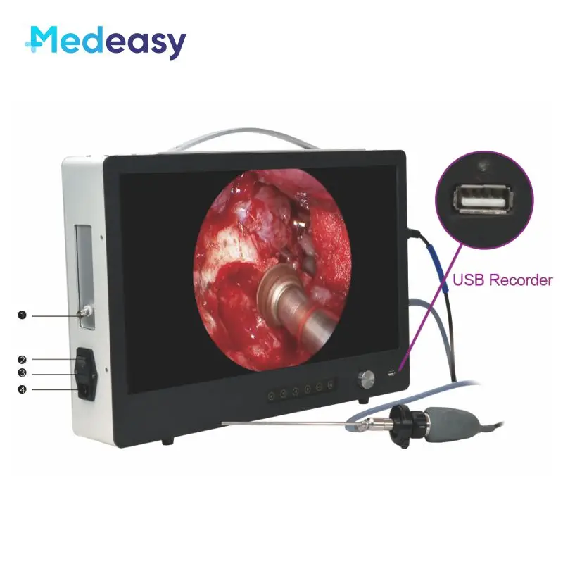 

Medical endoscope camera system with light source, Portable all in one full HD endoscope camera