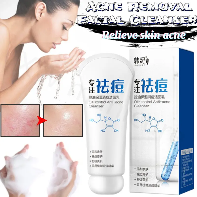 

Oil-controlling Moisturizing Anti-acne Cleanser Gentle Hydrating Refreshing Anti-acne Deep Cleansing Facial Cleanser 80g