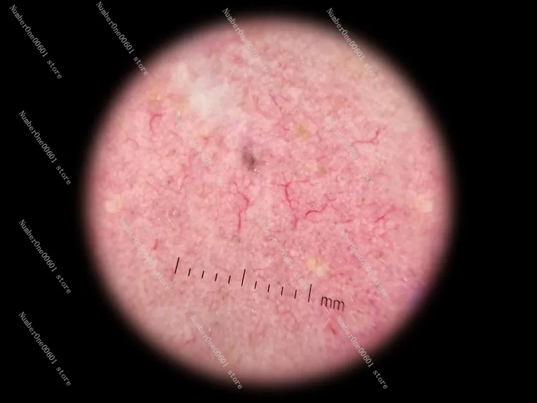 Портативный дерматоскоп увеличительное стекло поляризационный и