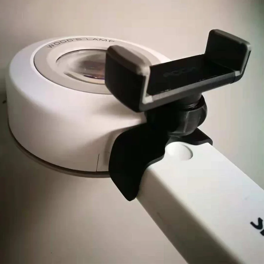 Медицинская светодиодная лампа для древесины SW-11 Анализ кожи Болезни