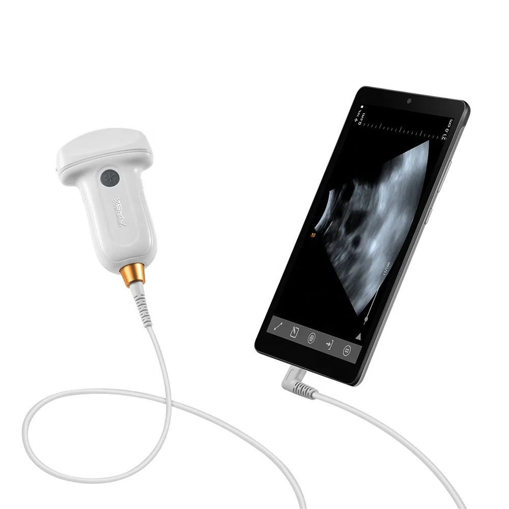 

USB Ultrasound Probe Ultrasound Diagnostic Machine Pet Veterinary Equipments Pocket