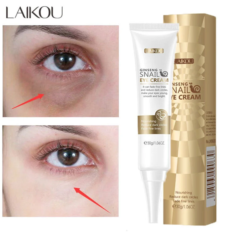

Snail Remove Dark Circles Eye Cream Niacinamide Whitening Moisturizing Eye Bags Lift Firm Brighten Anti-Wrinkle Eyes Serum Care