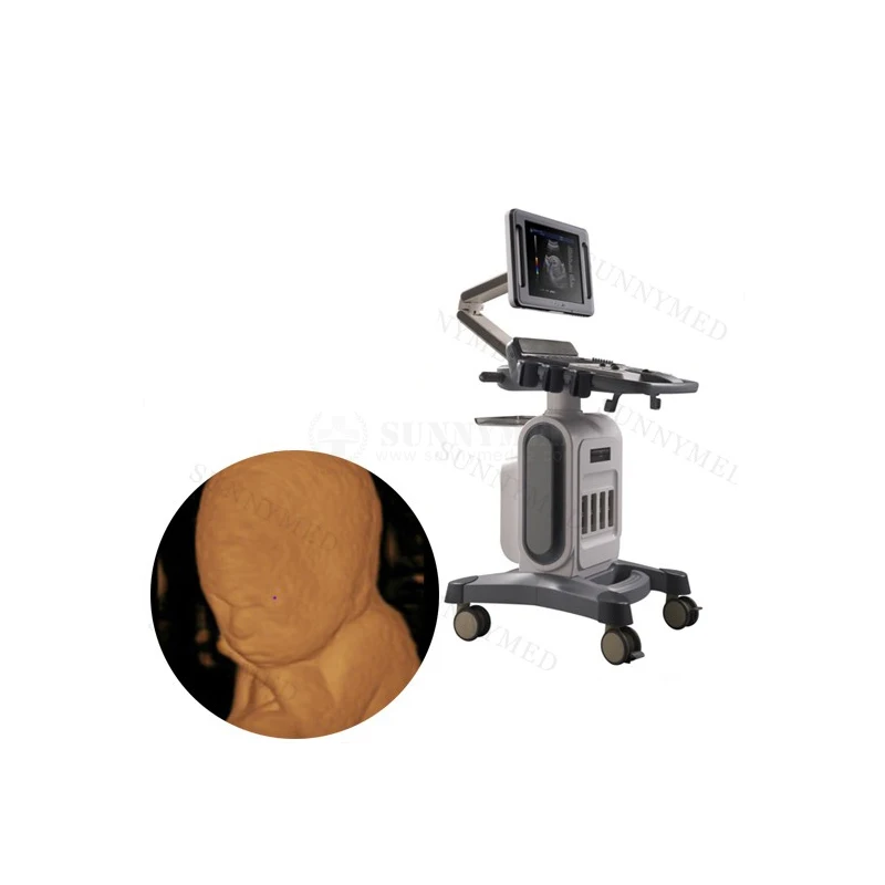 SY-A046 Больница Портативный цветной доплеровский сканер Echographie Инструменты