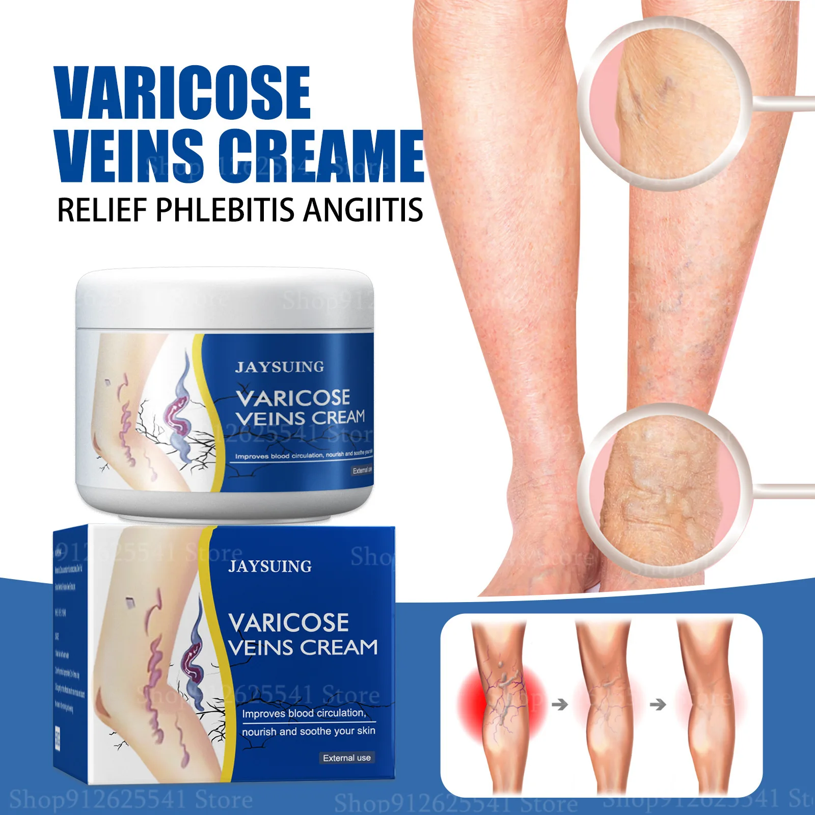 

50g Effective Spider Veins Treatment Varicose Veins Cream Legs Care Massage Ointment Earthworm Leg Pain Swelling Relief Cream