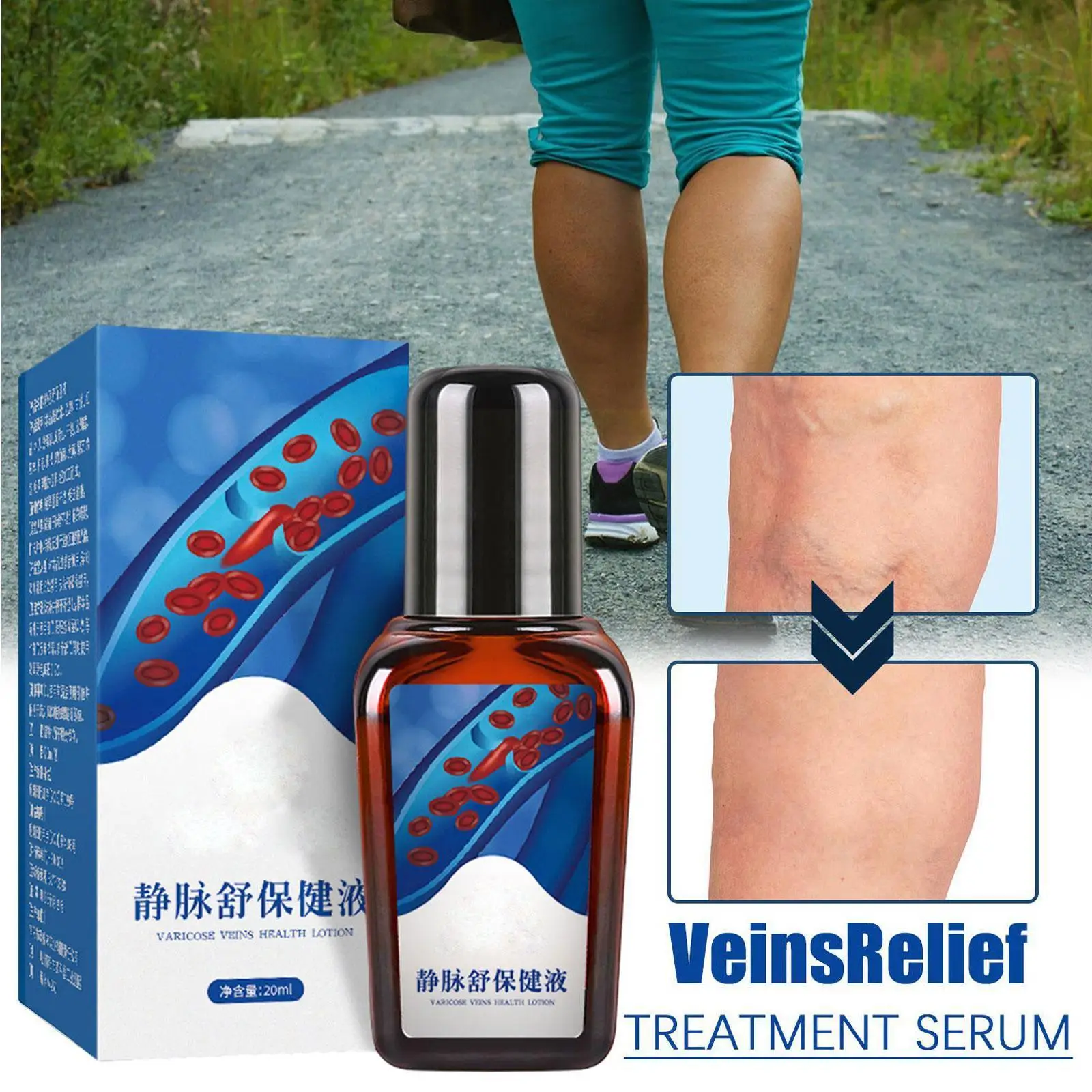 

Успокаивающее средство для лечения варикозного расширения вен, 20 мл