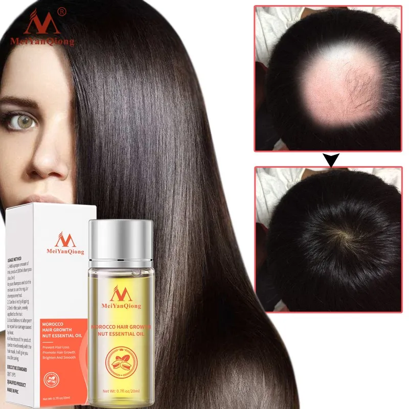5 шт. марокканских эфирных масел для ухода за сухими волосами питают поврежденные
