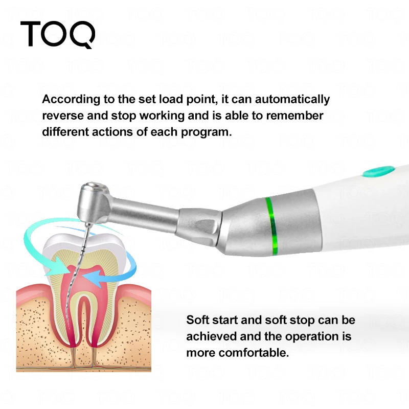 Стоматологический эндомотор беспроводной 16:1 против угла с редукционной