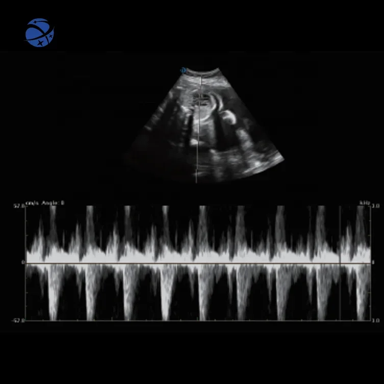 Новое поступление Цветной Допплер-сканер 3D/4D/5D тележка ультразвуковая машина для