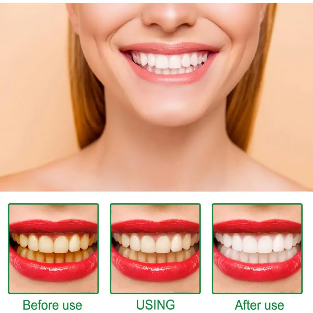 

Sturdy 3ml Useful Yellow Stain Remover Pen Solid Whitening Toothbrush Safe for Travel