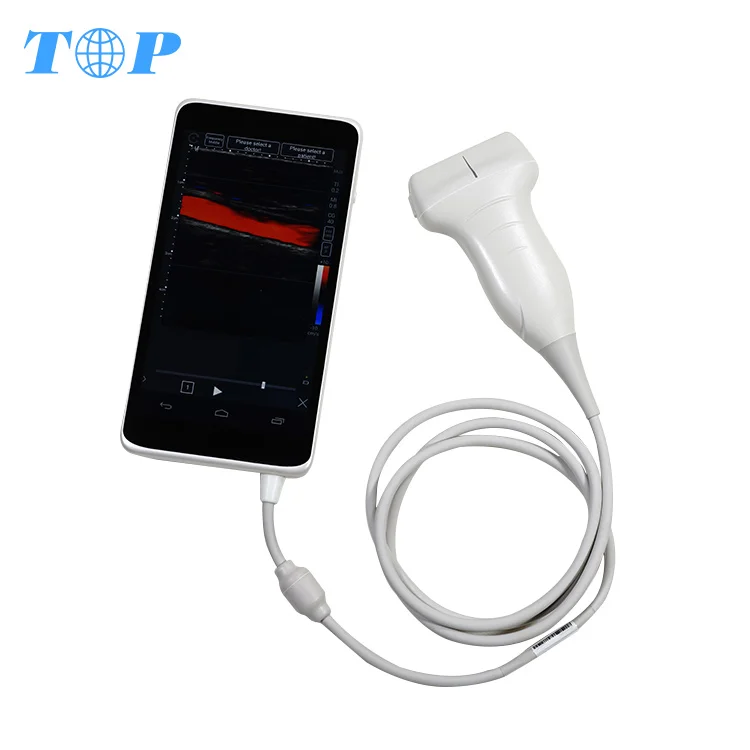 

TOP-A1025 Full Touch Screen Real Time Hand-held Color Doppler Ultrasound Scanner Portable Ultrasound Machine Echo Machine
