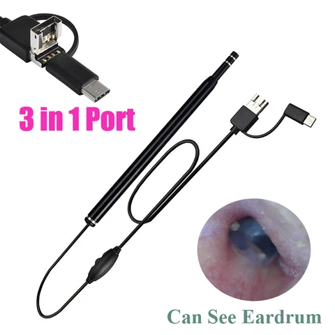 Медицинский USB-инструмент для чистки ушей, визуальный HD-монитор, отоскоп с мини-камерой, ручка для ухода за ушами, внутриканальный эндоскоп для чистки ушей