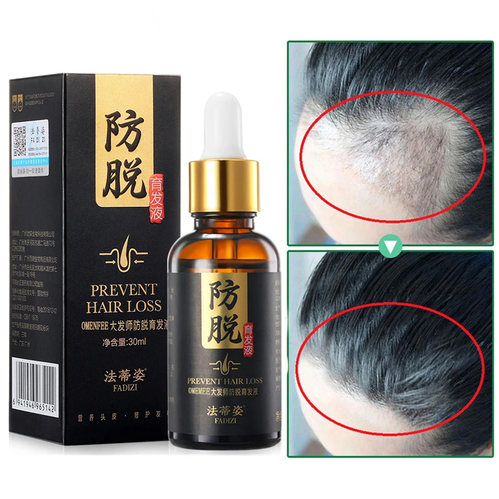 Moroccan Hair Growth Essential Oil Products Anti Hair Loss Treatment Serum Care Dry Frizz Repair Damage Nourish Hair Root Oil