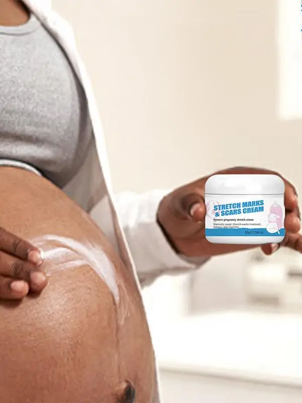 

Крем для предотвращения растяжек при беременности, нежный и без парабенов, натуральные ингредиенты, набор растяжек, уход за кожей, подарки для мам