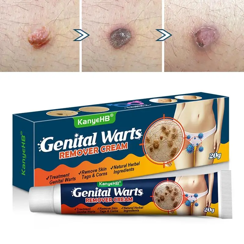 

Genital Mole Corrector Cream 20g Acuminatum Care Cream Skin Tags Removal And Remover Ointment Effective And Safe Solution