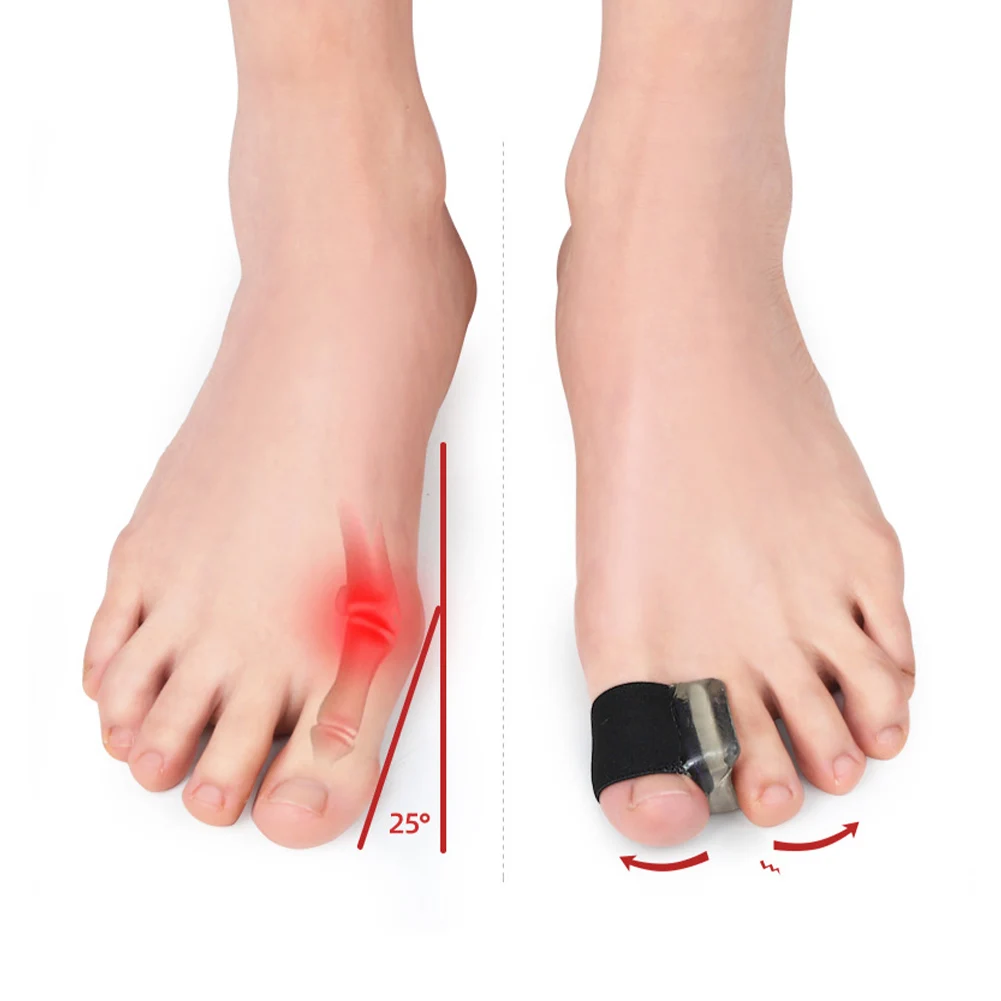 2Pcs=1Pair Silicone Toes Separator Bunion Bone Ectropion Adjuster Toes Outer Appliance Foot Care Tools Hallux Valgus Corrector