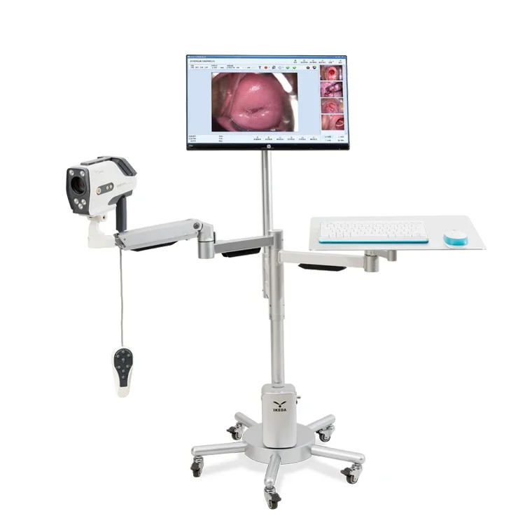 Full HD colpos cope для вагины Colposcopy