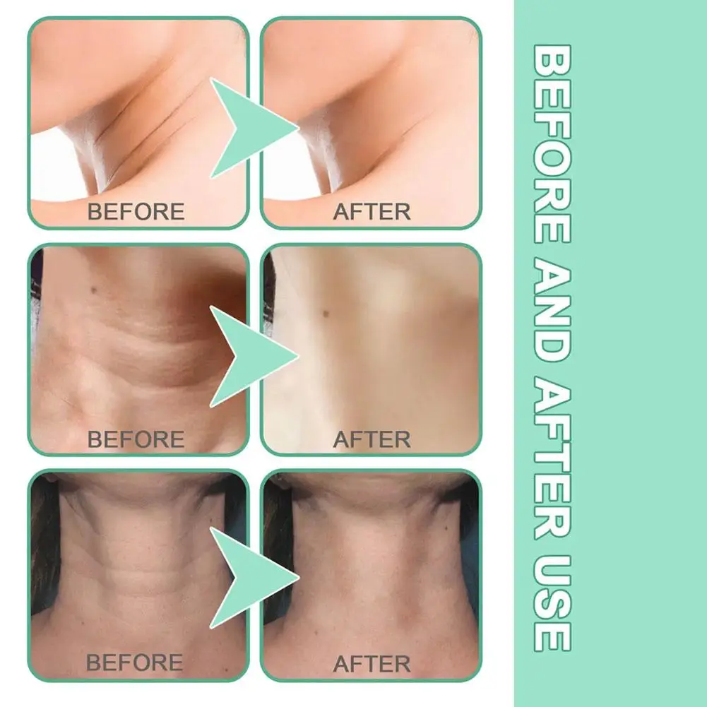 Подтяжка кожи шеи крем увлажняющий для подтяжки уменьшающий двойной подбородок