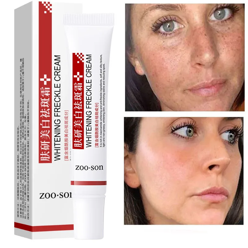 

1/2/3pcs Effective Whitening Freckle Cream 20g Remove Melasma Acne Spot Pigment Melanin Dark Spots Whitening Cream Skin Care