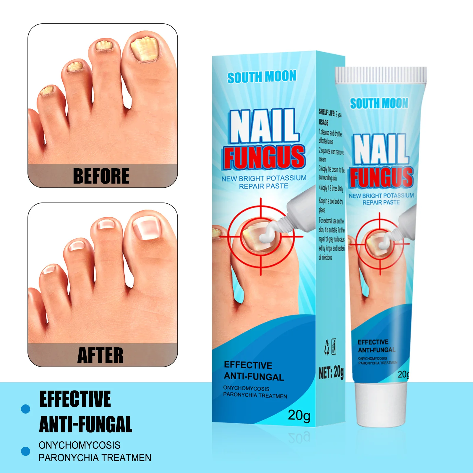 

20g Nail Fungus Removal Cream Nail Care Anti-infection Paronychia Onychomycosis Foot Toe Nail Fungus Removal Ointment Feet Care