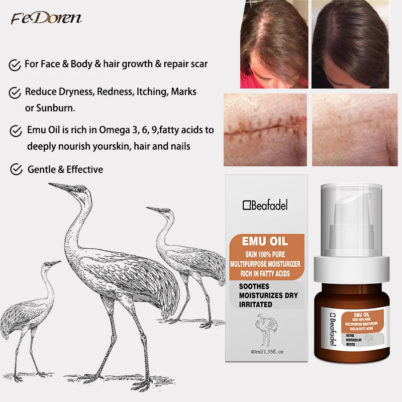 

Pure Emu oil skin healing Rich Omega lightening Treat eczema Skin Acne Powerfully Moisturizer hair growth Multipurpose skin Care