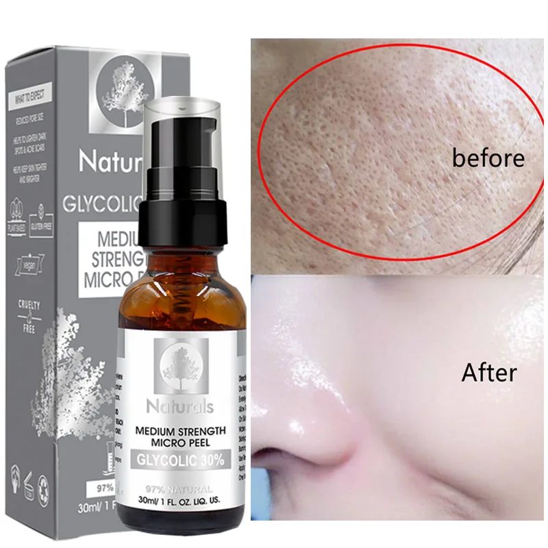 

Glycolic Acid 30% Shrink Pores Face Serum Cleaning Exfoliating Essence Whitening Oil Control Brighten Fade Dark Spots Skin Care