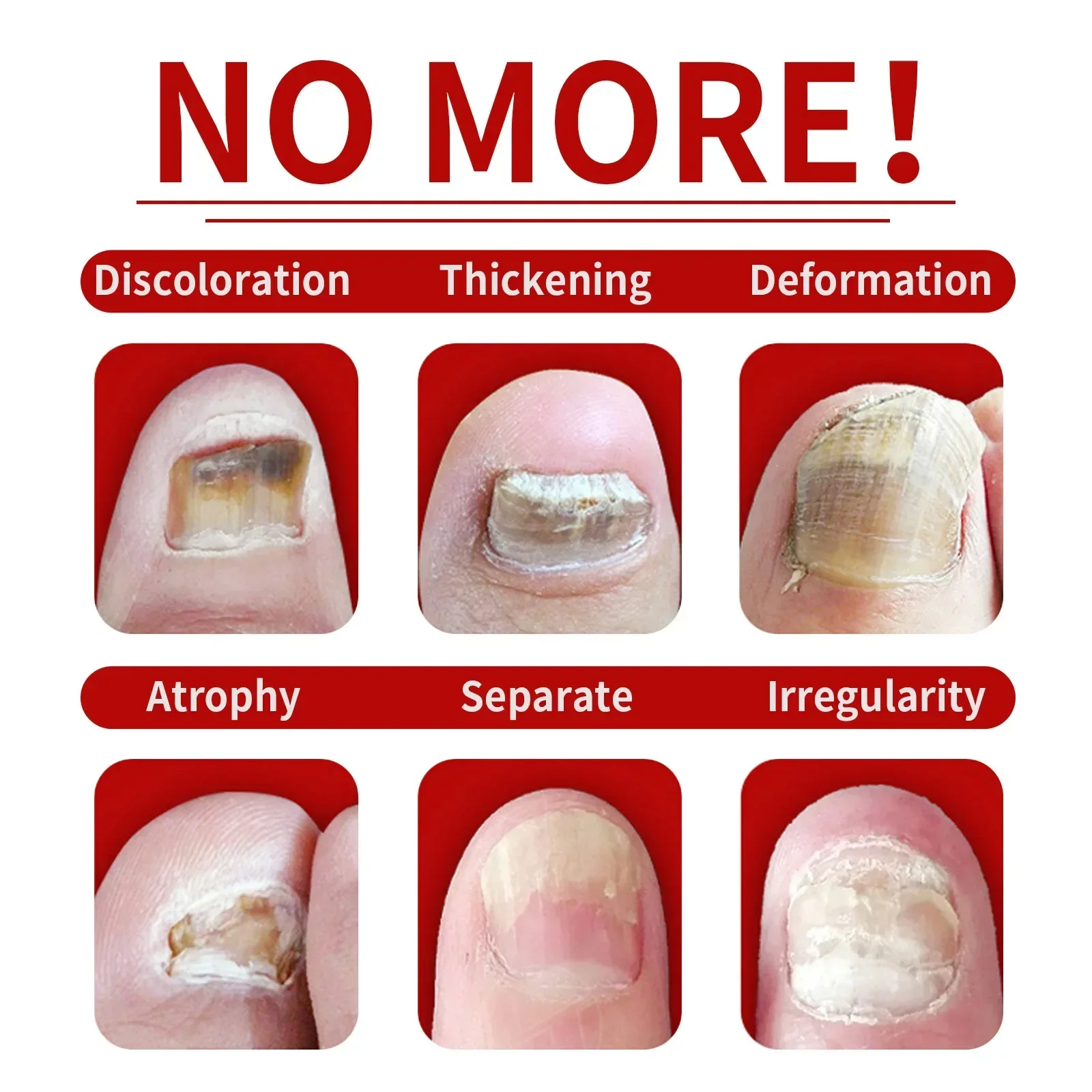 Сыворотка для лечения грибка ногтей средство восстановления при ногах уход за