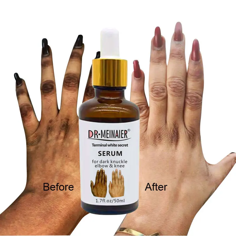 

Hand Whitening Serum Removing Dark Knuckles Elbow and Knee Melanin Hand Knuckle Glow Serum Whitening Hand Essence Skin Care 50ml