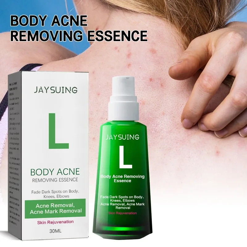 

Butt Acne Remove Cream Body Moisturizer Essence Acne Repair Serum Dark Spot Remover for Body Lotion Korean Skin Care Products